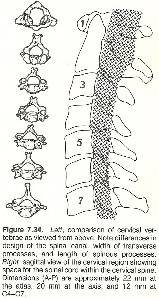 Regional Structural Characteristics lumbar spine diagram labeled 