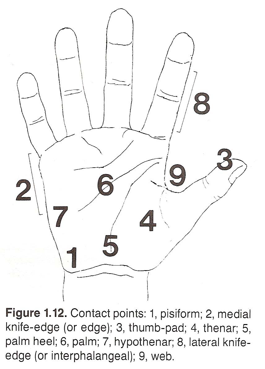 (2) it usually follows stress at some unguardedjoint motion,