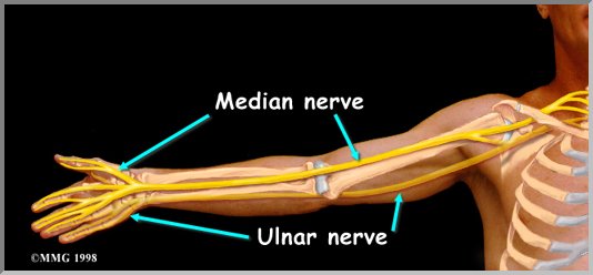 pinched nerve in arm